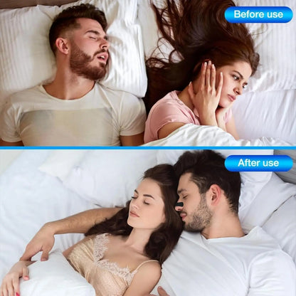 Anti Snoring Nose Strips for Breathing Correction