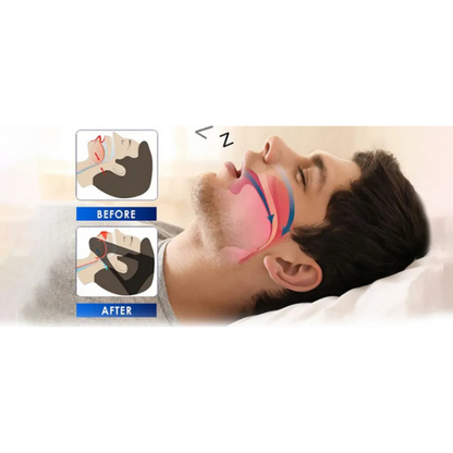 1 PC Silicone Anti-Snoring Corrector